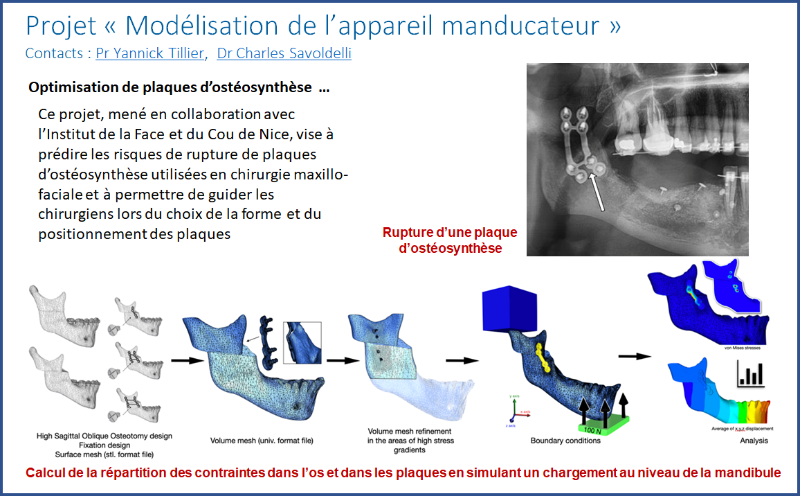 Appareil manducateur